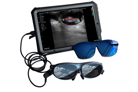 LIberty Scan - Lunettes